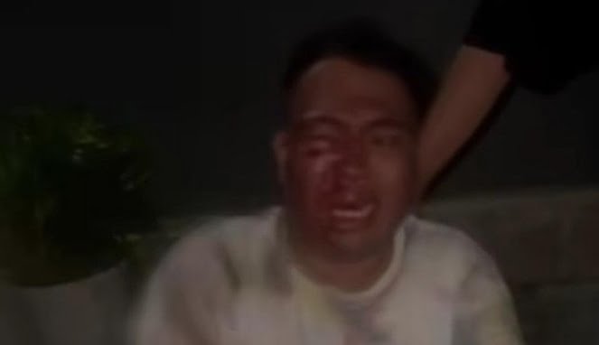 Tangkapan video layar, Empat Polisi di Bitung Diduga Aniaya Warga