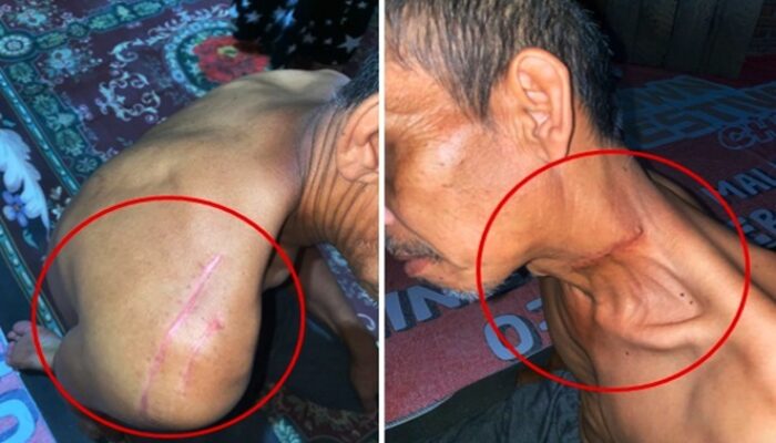 Suami Cacat Seumur Hidup Akibat Penganiayaan di Gowa, Suminah Tuntut Keadilan