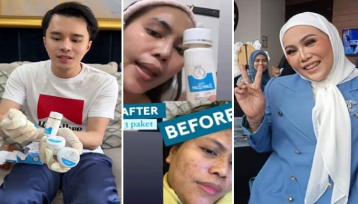 dr. Oky Review Zam-zam Whitening Cream, Imbau Stop Pakai Skincare Tanpa BPOM