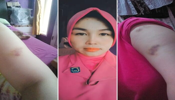 Pemilik Klinik di Makassar Diduga Aniaya Istri Polisi Ernawati