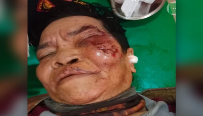 Ayah Sontoloyo Anak Kandung Tuna Wicara Diperkosa hingga Hamil 8 Bulan di Gowa