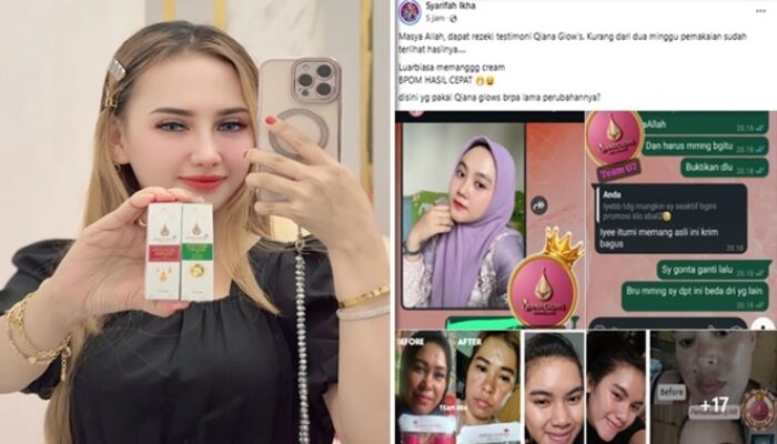 Produk Qiana Glow’s Viral dengan Hasil Instan, Netizen: Bisa Jadi Ada Hidrokuinon?