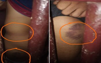 Propam Tak Responsif Adili 4 Oknum Polisi Barbar, Laporan Istri Korban di Takalar Mandek