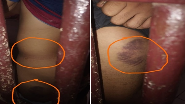 Propam Tak Responsif Adili 4 Oknum Polisi Barbar, Laporan Istri Korban di Takalar Mandek