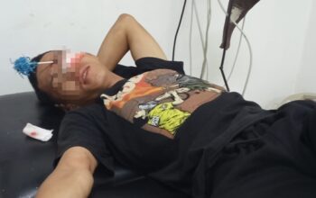 Korban penyerangan, Supriyadi, menerima perawatan medis usai dibusur di bagian pelipis mata sebelah kiri akibat serangan sekelompok geng motor di kawasan Panakkukang, Makassar, Senin (17/8/2026).