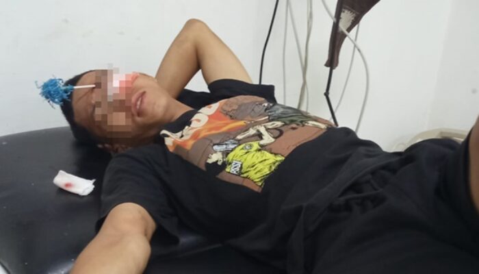 Dibusur Geng Motor Makassar, Anak Panah Menancap di Pelipis Supriyadi