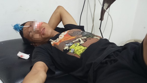 Korban penyerangan, Supriyadi, menerima perawatan medis usai dibusur di bagian pelipis mata sebelah kiri akibat serangan sekelompok geng motor di kawasan Panakkukang, Makassar, Senin (17/8/2026).